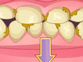 Bad Teeth Makeover - Play Free Game
