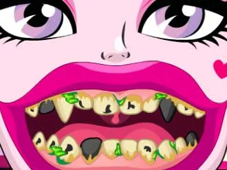 Draculaura Bad Teeth - Play Free Game